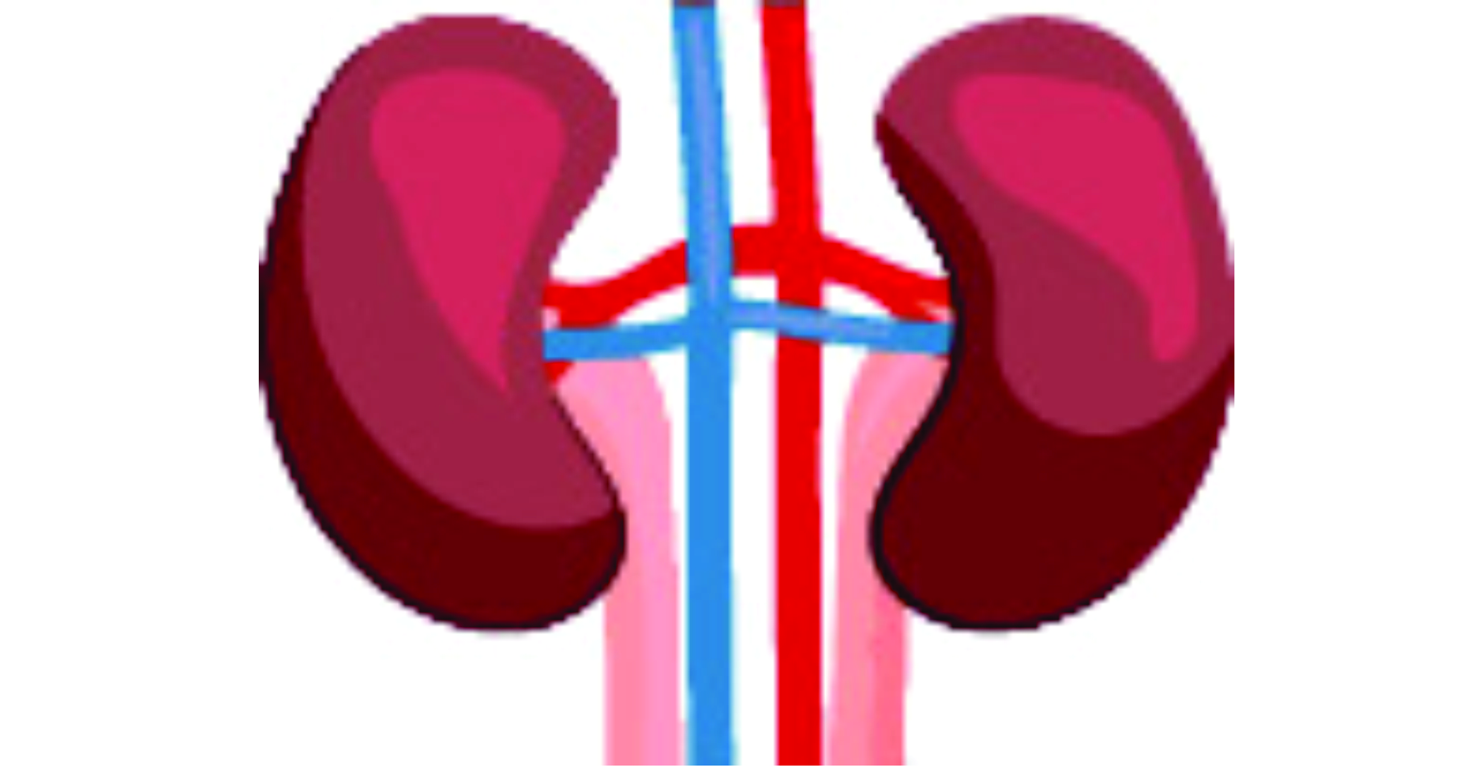Kidney Donation: Patients suffer for legal constraints