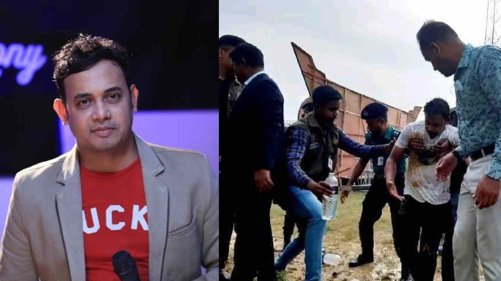 25 percent of Rony’s body burnt, Doctors hopeful about recovery