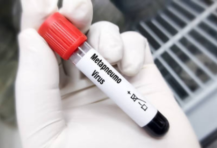 Rising concern over HMPV amid seasonal surge