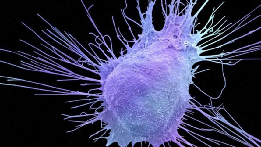 Prostate-cancer-cell-sem-web.jpg