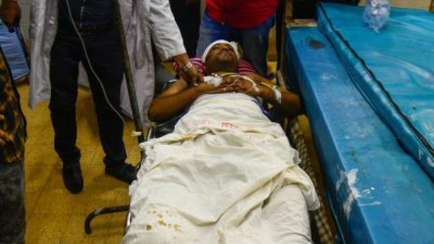 CU student loses both legs