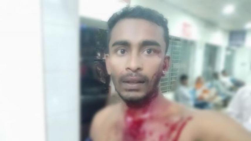 Dhaka University student Farid Hasan beat up by Chhatra League