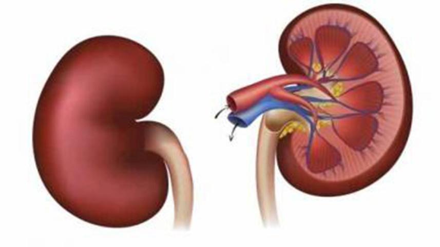 kidney decease