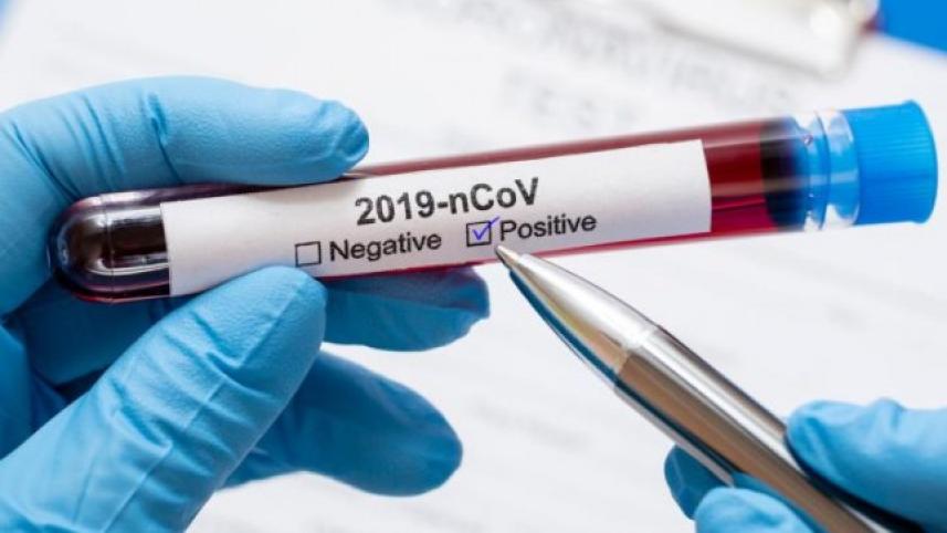 coronavirus test positive