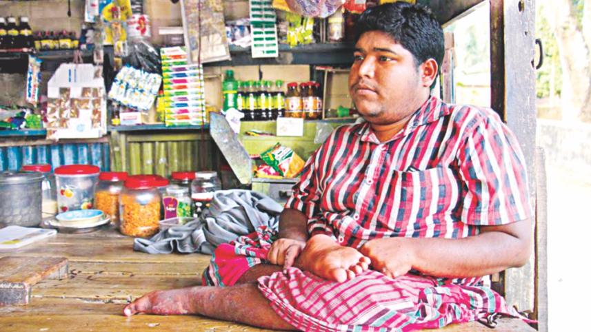 physically challenged 3.jpg