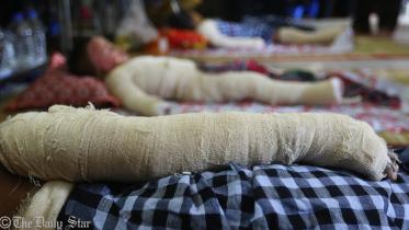 burn unit_palash.jpg