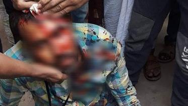 Journalist Sumon attacked