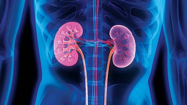 chronic-kidney-disease.jpg