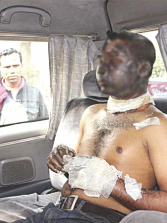 blockade burnt 1.jpg